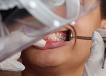 Governo retoma programa Brasil Sorridente para saúde bucal no SUS