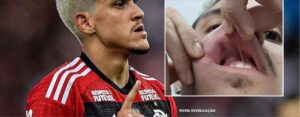 Flamengo Decide Punir Atacante Pedro por Indisciplina