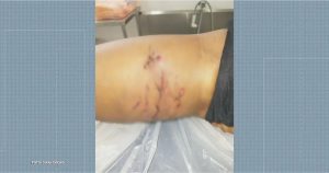 Mulher sofre ataque de Pitbull em Parque da Zona Sul do Rio