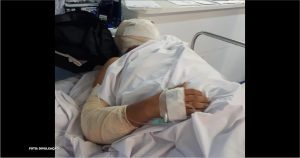 Motorista ferido retorna ao ônibus incendiado em busca de documentos