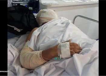 Motorista ferido retorna ao ônibus incendiado em busca de documentos