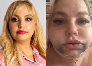 Dentista é denunciada no Rio após procedimento odontológico deixar paciente em estado grave e sob risco de morte.