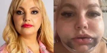 Dentista é denunciada no Rio após procedimento odontológico deixar paciente em estado grave e sob risco de morte.