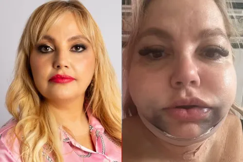 Dentista é denunciada no Rio após procedimento odontológico deixar paciente em estado grave e sob risco de morte.