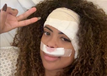 Marvvila realiza cirurgia no ouvido por tumor benigno; volta aos palcos em abril