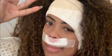 Marvvila realiza cirurgia no ouvido por tumor benigno; volta aos palcos em abril