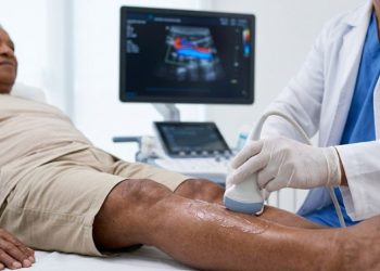 Check-up vascular preventivo melhora saúde circulatória e evita complicações no Brasil
