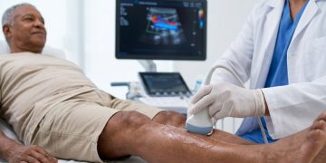 Check-up vascular preventivo melhora saúde circulatória e evita complicações no Brasil