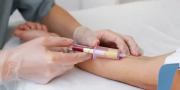 Ministério da Saúde disponibiliza teste rápido de dengue no SUS para diagnóstico precoce