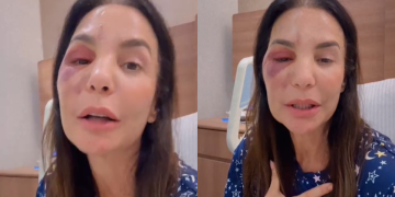 Ivete Sangalo passa por cirurgia após queda devido a síndrome vasovagal e retoma shows.