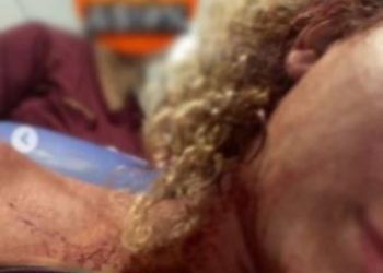 Mulher é agredida após recusar investida em Rocha Miranda, na Zona Norte