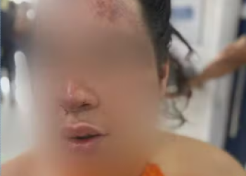 Filho de vítima revela tentativa de defesa em violência de ex-companheiro em São Gonçalo