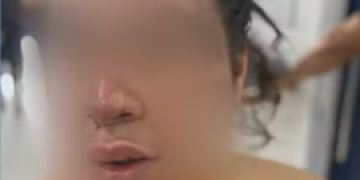 Filho de vítima revela tentativa de defesa em violência de ex-companheiro em São Gonçalo