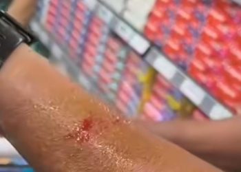 Vídeo revela caso de ataque de ratos a consumidor em supermercado de Niterói