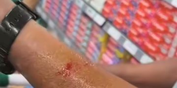 Vídeo revela caso de ataque de ratos a consumidor em supermercado de Niterói