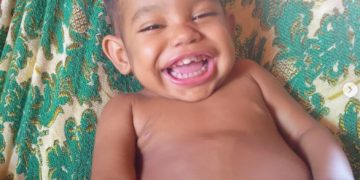 Família de Levi Moura busca R$ 25 mil para transplante de fígado devido à Síndrome de Caroli