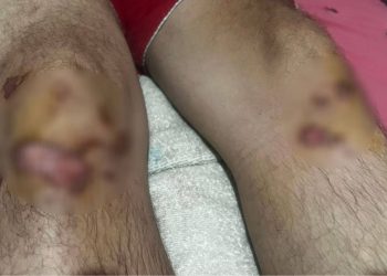 Motorista de aplicativo é brutalmente agredido após corrida de R$ 20 em São Gonçalo