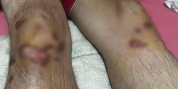 Motorista de aplicativo é brutalmente agredido após corrida de R$ 20 em São Gonçalo