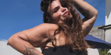 Influenciadora Thais Carla comemora um ano de cirurgia bariátrica com perda de 100 kg