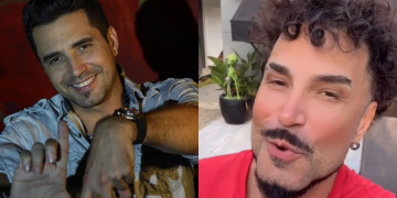 Latino surpreende fãs com transformação facial e novo visual nas redes sociais