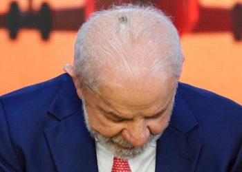 Lula realiza cirurgia para remoção de carcinoma basocelular no couro cabeludo