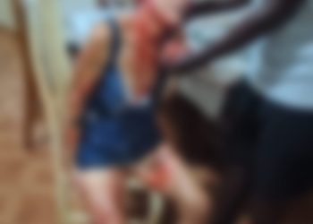 Mulher é atacada por pitbull no Rio após comando do namorado; vítima recebe alta