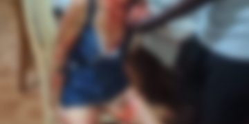 Mulher é atacada por pitbull no Rio após comando do namorado; vítima recebe alta