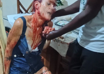 Mulher é atacada por pitbull em condomínio na Zona Norte do Rio