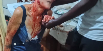 Mulher é atacada por pitbull em condomínio na Zona Norte do Rio