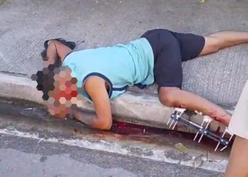 Paciente grave após acidente de moto em São Gonçalo mobiliza unidade de emergência