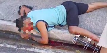 Paciente grave após acidente de moto em São Gonçalo mobiliza unidade de emergência