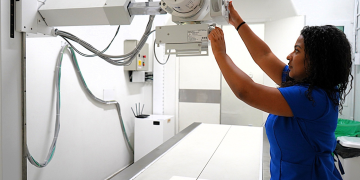 Volta Redonda realiza mais de 50 mil exames com inteligência artificial na saúde pública