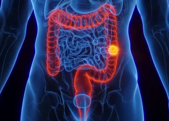 Ministério da Saúde incorpora teste imunocromático fecal ao SUS para detecção do câncer de intestino
