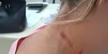 Mulher denuncia agressão de policial civil após término de relacionamento em Niterói