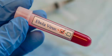 OMS declara surto de ebola na África como emergência de saúde pública internacional