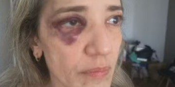 Passageira sofre agressão por motociclista após reclamar de segurança durante corrida no Rio