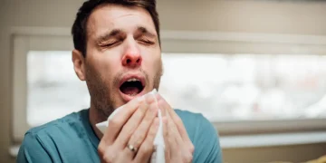 Opas alerta para início da temporada de influenza A(H3N2) variante K no Hemisfério Sul