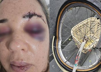 Enfermeira de Niterói busca Justiça após atropelamento e fuga de motociclista