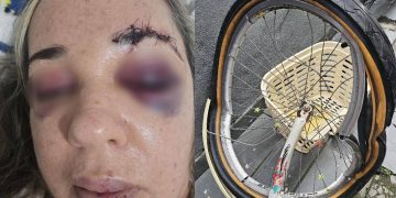 Enfermeira de Niterói busca Justiça após atropelamento e fuga de motociclista