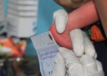 Dia do teste do pezinho reforça importância da triagem neonatal para a saúde infantil