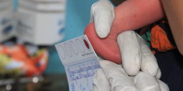 Dia do teste do pezinho reforça importância da triagem neonatal para a saúde infantil