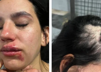 Briga em festa de crossfit em Belford Roxo causa demissões e repercussão de agressões