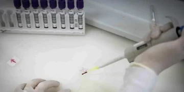 Mulher que voltou do Congo é monitorada em São Paulo por suspeita de ebola