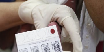 Teste do pezinho no Rio detecta 54 doenças e amplia rastreamento neonatal