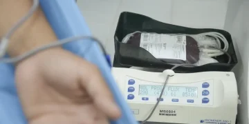 Ministério da Saúde aprova protocolo para uso de emicizumabe em crianças com hemofilia A sem inibidores